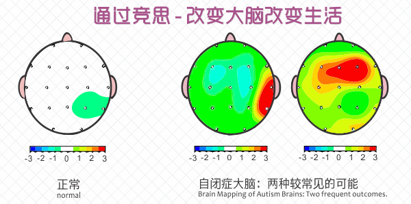 自閉癥訓(xùn)練方案